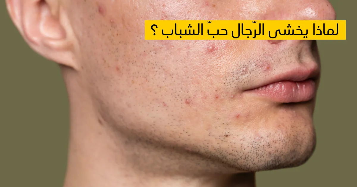 لماذا يخشى الرّجال حبّ الشباب ؟